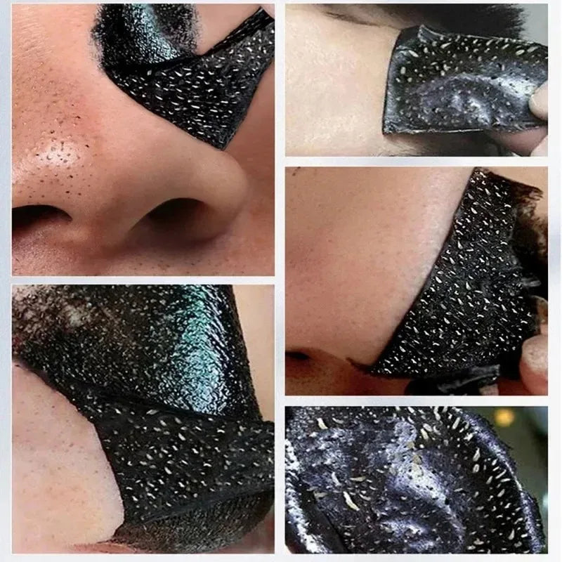 LANBENA Blackhead Remover Peel Mask